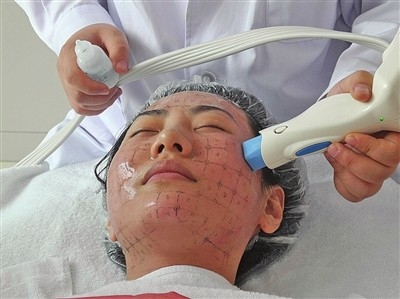 10MHZ Radio Frequencies Acne Removal Machine With Non Invasive