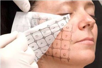 Non Surgical RF Face Lifting Acne Removal Machine For Skin Rejuvenation